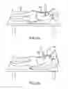 Fig. 02 - Active compression decompression and upper body elevation system