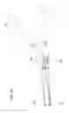 Fig. 19 - Active compression decompression and upper body elevation system