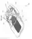 Fig. 53 - Active compression decompression and upper body elevation system