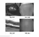 Fig. 09 - Materials and methods for delivering compositions to selected tissues