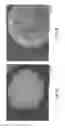 Fig. 02 - FORMULATIONS OF L-ORNITHINE PHENYLACETATE