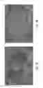 Fig. 09 - FORMULATIONS OF L-ORNITHINE PHENYLACETATE