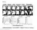 Fig. 09 - Methods And Compositions For The Treatment Of Open And Closed Wound Spinal Cord Injuries