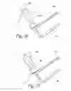 Fig. 20 - Device for trans anal irrigation