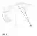 Fig. 09 - Trailer coupler lock