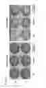 Fig. 04 - CULTURE MEDIUM FOR STEM CELL DIFFERENTIATION