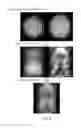 Fig. 04 - Simultaneous multislice MRI with random gradient encoding