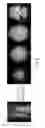 Fig. 06 - Simultaneous multislice MRI with random gradient encoding