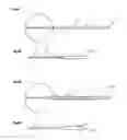 Fig. 04 - Pigtail fiber module
