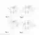 Fig. 03 - Moving a nonlinear crystal or a saturable absorber in two dimensions
