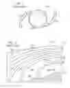 Fig. 02 - Diffractive trifocal lens