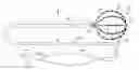 Fig. 01 - ARTIFACT CANCELLATION TO SUPPRESS FAR-FIELD ACTIVATION DURING ELECTROPHYSIOLOGY MAPPING