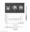 Fig. 06 - METHODS OF TREATING BRAIN DISORDERS OR IDENTIFYING BIOMARKERS RELATED THERETO