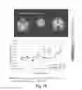 Fig. 07 - METHODS OF TREATING BRAIN DISORDERS OR IDENTIFYING BIOMARKERS RELATED THERETO