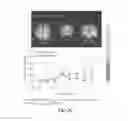 Fig. 08 - METHODS OF TREATING BRAIN DISORDERS OR IDENTIFYING BIOMARKERS RELATED THERETO
