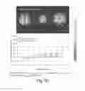Fig. 09 - METHODS OF TREATING BRAIN DISORDERS OR IDENTIFYING BIOMARKERS RELATED THERETO