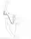 Fig. 01 - Needle for a minimally invasive surgical suturing device