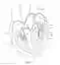 Fig. 02 - Needle for a minimally invasive surgical suturing device