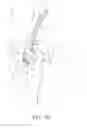 Fig. 09 - Needle for a minimally invasive surgical suturing device