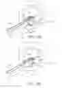 Fig. 22 - Needle for a minimally invasive surgical suturing device