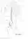 Fig. 72 - Needle for a minimally invasive surgical suturing device