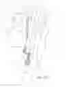Fig. 76 - Needle for a minimally invasive surgical suturing device