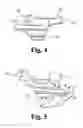 Fig. 04 - Low profile patient specific cutting blocks for a knee joint