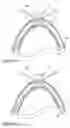 Fig. 12 - Devices and methods for minimally invasive tissue removal