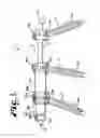 Fig. 02 - Dynamic stabilization members with elastic and inelastic sections