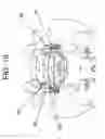 Fig. 07 - FACET FIXATION PROSTHESIS