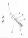 Fig. 09 - FACET FIXATION PROSTHESIS