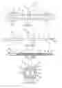 Fig. 08 - Elongate medical device including chamfered ring electrode and variable shaft
