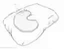 Fig. 01 - Sleep device