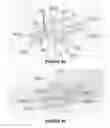 Fig. 07 - Device for counting and dispensing objects