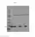 Fig. 06 - Medicament and method for treating innate immune response diseases