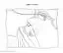 Fig. 02 - CATHETER VACUUM DRESSING APPARATUS AND METHODS OF USE