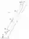 Fig. 02 - BALLOON FOR MEDICAL DEVICE