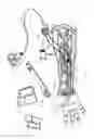 Fig. 02 - Multi-branch stimulation electrode for subcutaneous field stimulation