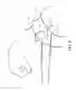 Fig. 09 - Method and apparatus for applying neuromuscular electrical stimulation