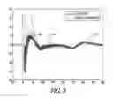 Fig. 08 - Methods and apparatus for managing multiple cathode pacing
