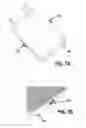 Fig. 08 - SYSTEM, APPARATUS AND METHOD FOR POST-MOLDING INSERTION OF ELECTRICAL CONTACTS