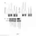 Fig. 02 - Oligonucleotides and methods for inhibiting or reducing bacterial biofilms