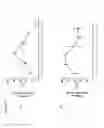 Fig. 06 - COMPOSITIONS AND METHODS FOR ASSESSING ACUTE REJECTION IN RENAL TRANSPLANTATION