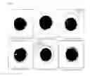 Fig. 08 - LACTIC ACID BACTERIUM LACTOBACILLUS FERMENTUM ISOLATED FROM ADULTS IN LONGEVITY VILLAGE, HELPFUL FOR DEFECATION