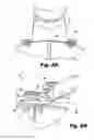Fig. 05 - Brackets for gas turbine engine components