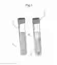Fig. 02 - Method for analyzing blood samples for detection of pathologies