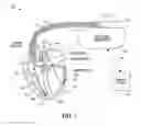 Fig. 02 - Multi-sensor body fluid volume index
