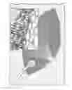 Fig. 01 - Negative pressure wound closure device