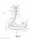 Fig. 04 - Ligation clip with flexible clamping feature