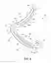 Fig. 05 - Ligation clip with flexible clamping feature